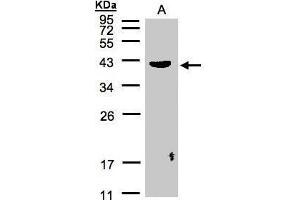 WB Image Sample(30 μg of whole cell lysate) A:Raji, 12% SDS PAGE antibody diluted at 1:500 (Pleckstrin Antikörper  (C-Term))