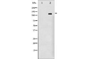 Western blot analysis of EGFR phosphorylation expression in 293 whole cell lysates,The lane on the left is treated with the antigen-specific peptide.