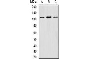 Western blot analysis of eIF3C expression in HepG2 (A), SW620 (B), mouse testis (C) whole cell lysates. (EIF3C Antikörper)