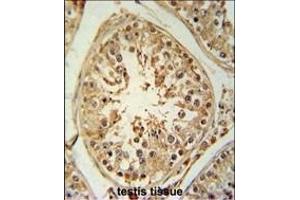 Immunohistochemistry (Paraffin-embedded Sections) (IHC (p)) image for anti-Zinc Finger and BTB Domain Containing 5 (ZBTB5) (AA 178-206), (N-Term) antibody (ABIN651495)