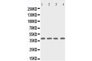 Anti-p53R2 antibody, Western blotting Lane 1: Rat Thymus Tissue Lysate Lane 2: MCF-7 Cell Lysate Lane 3: A431 Cell Lysate Lane 4: HELA Cell Lysate (RRM2B Antikörper  (C-Term))