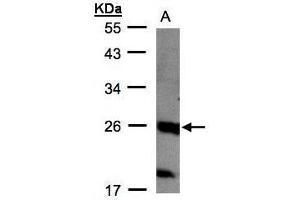 WB Image Sample(30 μg of whole cell lysate) A:MOLT4, 12% SDS PAGE antibody diluted at 1:1000 (C1orf57 Antikörper  (C-Term))