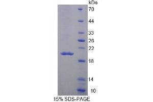 SDS-PAGE analysis of Mouse MARCO Protein. (MARCO Protein)