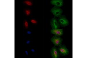 ABIN6256860 and ABIN6274329 staining  cells by IF/ICC. (FOXC1 Antikörper  (Internal Region))