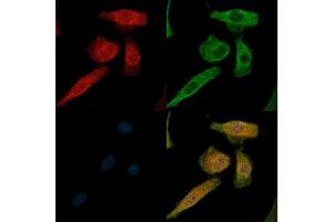 Phospho-IL4R/CD124 (Tyr497) Antibody staining A549 cells(H2O2 treatment) by IF/ICC. (IL4 Receptor Antikörper  (pTyr497))