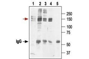Immunoprecipitation of KV11. (KCNH2 Antikörper  (Extracellular))