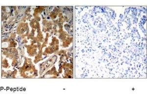 Image no. 1 for anti-Adducin 1 (Alpha) (ADD1) (pSer726) antibody (ABIN196918) (alpha Adducin Antikörper  (pSer726))