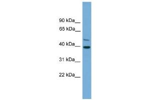 WB Suggested Anti-C21orf58 Antibody Titration: 0. (C21orf58 Antikörper  (N-Term))