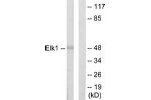 Western blot analysis of extracts from HeLa cells, using Elk1 Antibody. (ELK1 Antikörper  (AA 1-50))