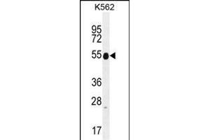 Keratin 25 Antikörper  (C-Term)