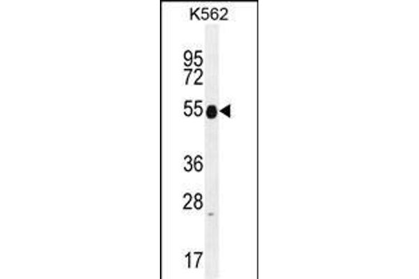 Keratin 25 Antikörper  (C-Term)