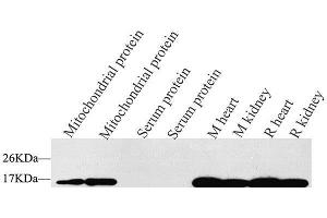 Western Blot analysis of various samples using COX4I1 Polyclonal Antibody at dilution of 1:1500. (COX IV Antikörper)