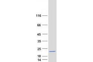 Validation with Western Blot (SCP2D1 Protein (Myc-DYKDDDDK Tag))
