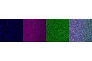 Immunohistochemistry (IHC) image for anti-Insulin-Like Growth Factor Binding Protein 6 (IGFBP6) antibody (ABIN7456279) (IGFBP6 Antikörper)