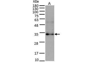 WB Image Sample (15 ug of whole cell lysate) A: HUVEC antibody diluted at 1:5000 (FGF10 Antikörper)