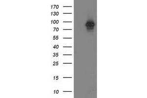 Western Blotting (WB) image for anti-Protein Kinase C, epsilon (PRKCE) antibody (ABIN1500232)