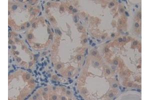 Immunohistochemistry (IHC) image for anti-Caspase Recruitment Domain Family, Member 9 (CARD9) (AA 26-283) antibody (ABIN7443479)