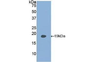 Detection of Recombinant PLAA, Human using Polyclonal Antibody to Phospholipase A2 Activating Protein (PLAP) (PLAA Antikörper  (AA 162-312))