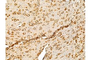 ABIN7094672 and ABIN7098723 at 1/100 staining Rat brain tissue by IHC-P. (PURA Antikörper  (Internal Region))