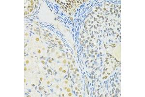 Immunohistochemistry of paraffin-embedded rat ovary using BRCA1 antibody (ABIN6291827) at dilution of 1:100 (40x lens). (BRCA1 Antikörper)