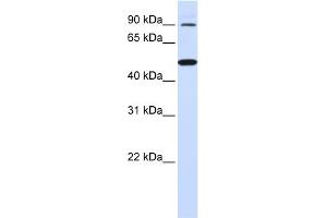 WB Suggested Anti-RHBDF1 Antibody Titration:  0.