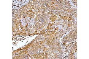 IHC analysis of CRABP2 using anti-CRABP2 antibody (ABIN7602146).