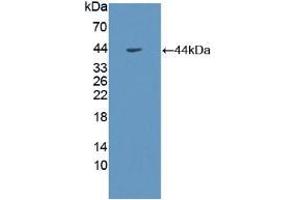 Western blot analysis of recombinant Human GHR. (Growth Hormone Receptor Antikörper  (AA 315-574))