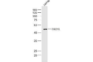 SW480 lysates probed with ERO1L Polyclonal Antibody, Unconjugated  at 1:300 dilution and 4˚C overnight incubation.
