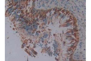 #VALUE! (SERPINB3 Antikörper  (AA 1-210))