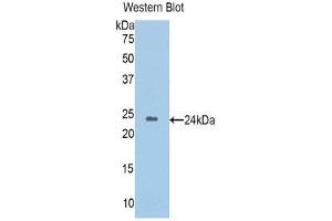 Western Blotting (WB) image for anti-Homogentisate 1,2-Dioxygenase (HGD) (AA 8-205) antibody (ABIN1176266) (HGD Antikörper  (AA 8-205))