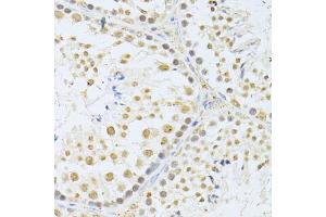 Immunohistochemistry of paraffin-embedded mouse testis using AKT1 antibody (ABIN5997218) at dilution of 1/100 (40x lens). (AKT1 Antikörper)