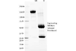 SDS-PAGE Analysis Purified Nuclear Membrane Marker Mouse Monoclonal Antibody (NM97). (Nuclear Membrane Marker Antikörper)