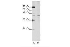Image no. 3 for anti-Surfeit 6 (SURF6) (AA 191-240) antibody (ABIN202343)