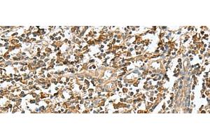 Immunohistochemistry of paraffin-embedded Human tonsil tissue using RAB23 Polyclonal Antibody at dilution of 1:50(x200) (RAB23 Antikörper)