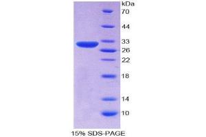 SDS-PAGE (SDS) image for serpin Peptidase Inhibitor, Clade B (Ovalbumin), Member 3 (SERPINB3) (AA 1-210) protein (His tag) (ABIN2126844)