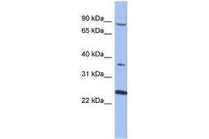 Image no. 1 for anti-Membrane Protein, Palmitoylated 3 (MAGUK P55 Subfamily Member 3) (MPP3) (AA 35-84) antibody (ABIN6744048) (MPP3 Antikörper  (AA 35-84))