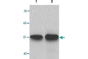 Western blot analysis of ZIP9 in HepG2 cell lysate with SLC39A9 polyclonal antibody  at 1 ug/mL (lane 1) and 2 ug/mL (lane 2).
