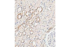 Immunohistochemical analysis of paraffin-embedded human kidney tissue using B performed on the Leica® BOND RXm. (MUC20 Antikörper  (C-Term))
