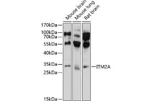 Western blot analysis of extracts of various cell lines, using ITM2A antibody (ABIN6128106, ABIN6142603, ABIN6142604 and ABIN6214624) at 1:1000 dilution. (ITM2A Antikörper  (AA 1-263))