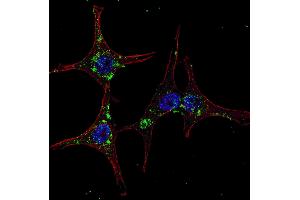 Fluorescent confocal image of HeLa cells stained with SYVN1 (HRD1) antibody. (SYVN1 Antikörper  (C-Term))