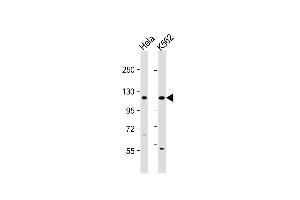 Western Blot at 1:1000 dilution Lane 1: Hela whole cell lysate Lane 2: K562 whole cell lysate Lysates/proteins at 20 ug per lane. (DDX11 Antikörper  (C-Term))