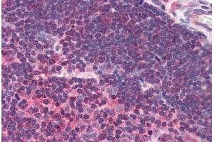 Human Thymus (formalin-fixed, paraffin-embedded) stained with UNC13D antibody ABIN290189 at 2. (UNC13D Antikörper  (AA 967-980))