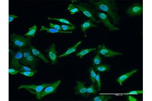 Immunofluorescence of monoclonal antibody to HECTD2 on HeLa cell.