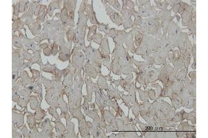 Immunohistochemistry (Formalin-fixed Paraffin-embedded Sections) (IHC (fp)) image for anti-Sarcoglycan, beta (43kDa Dystrophin-Associated Glycoprotein) (SGCB) (AA 87-196) antibody (ABIN562847)