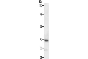 Gel: 10 % SDS-PAGE, Lysate: 40 μg, Lane: SKOV3 cells, Primary antibody: ABIN7129267(DTX3 Antibody) at dilution 1/200, Secondary antibody: Goat anti rabbit IgG at 1/8000 dilution, Exposure time: 10 minutes