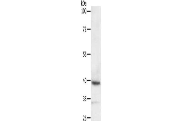 Deltex Homolog 3 antibody