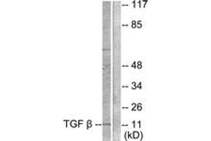Western blot analysis of extracts from COS7 cells, using TGF beta3 Antibody. (TGFB3 Antikörper  (AA 261-310))