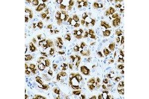 Immunohistochemical analysis of GHRH staining in human gastric cancer formalin fixed paraffin embedded tissue section. (GHRH Antikörper)