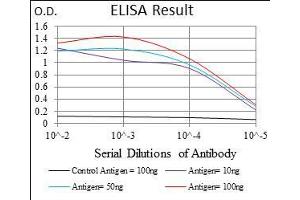 Black line: Control Antigen (100 ng), Purple line: Antigen(10 ng), Blue line: Antigen (50 ng), Red line: Antigen (100 ng), (ADRP Antikörper  (AA 286-437))