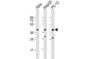Western Blot at 1:2000 dilution Lane 1: Hela whole cell lysate Lane 2: HepG2 whole cell lysate Lane 3: PC-12 whole cell lysate Lysates/proteins at 20 ug per lane.